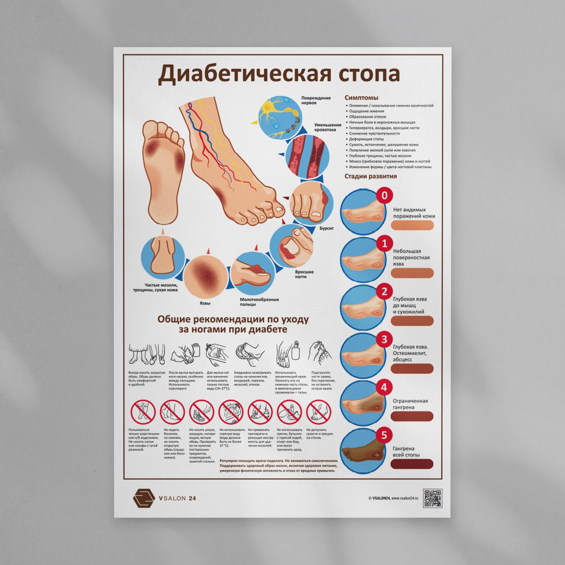 Диабетическая стопа (плакат) ᐈ купить по низкой цене в интернет-магазине  VSALON24